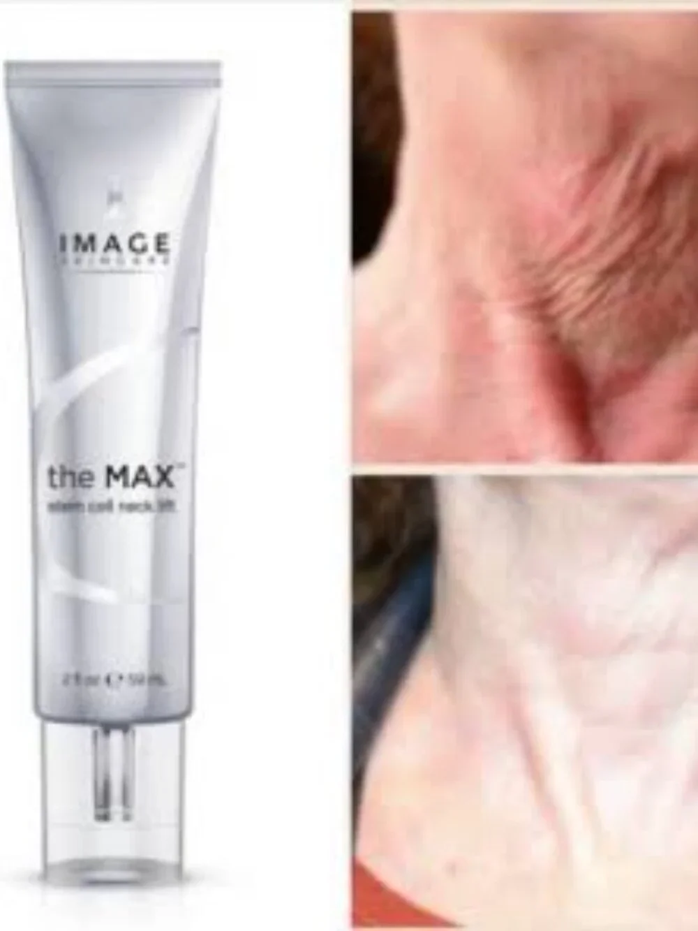 Image Skincare winner dermascope